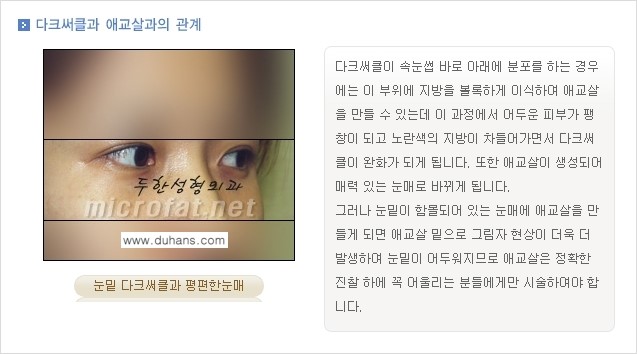 [두한성형외과의 경쟁력 있는 지방이식] - [눈밑 애교살 미세지방이식 1.] 관련 이미지 3