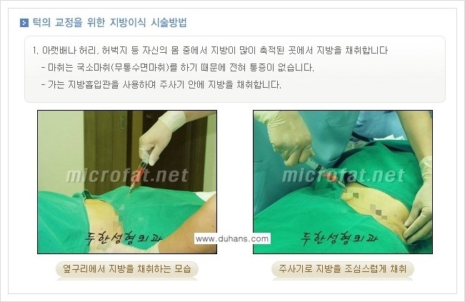 [두한성형외과의 경쟁력 미세지방이식] - [무턱교정, 턱 미세지방이식 안내 1.] 관련 이미지 8