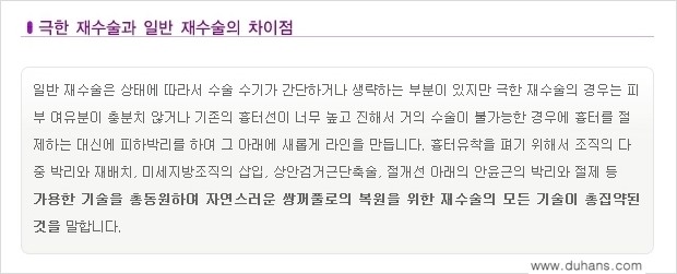 [두한성형외과 경쟁력 쌍꺼풀 재수술] - [망가진 쌍꺼풀 라인을 교정하는 극한재수술 ①] 관련 이미지 4