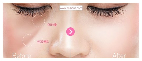 [두한성형외과 경쟁력 멀티성형] - [다크써클 + 인디언밴드 콤비 프로그램 안내] 관련 이미지 1