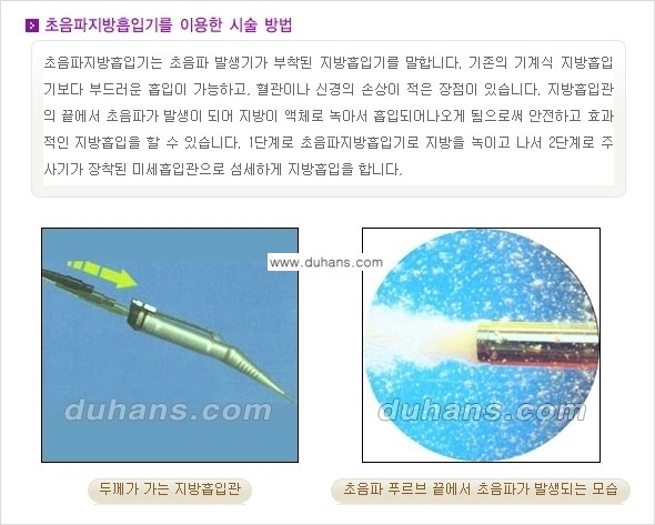 ​​​﻿[두한성형외과 경쟁력 간편지방흡입] - [볼살지방흡입, 턱선지방흡입 안내] 관련 이미지 6