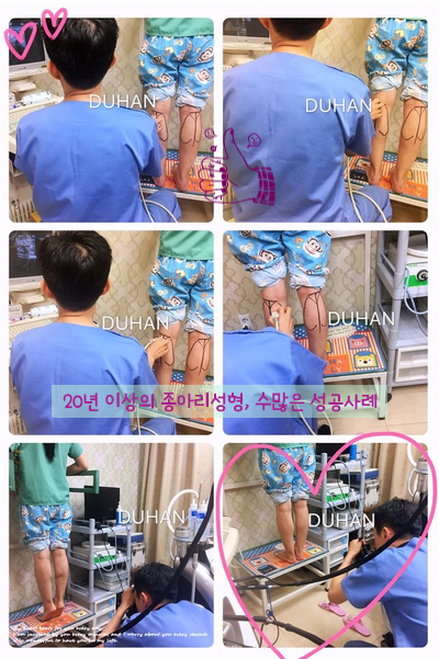 ​[두한성형외과 종아리성형] - [종아리성형 실패 원인] 관련 이미지 2
