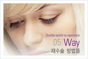 [두한성형외과 경쟁력 극한눈(쌍꺼풀)재수술] - [절개선 아래가 두툼한 소세지 쌍꺼풀 교정] 관련 이미지 1