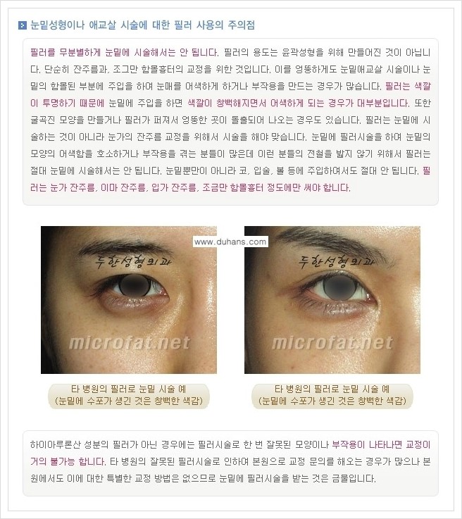 [두한성형외과 경쟁력 주름성형] - [주름교정을 위한 필러(쥬비덤) 시술] 관련 이미지 6