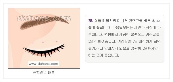 ⁠⁠[두한성형외과 경쟁력 눈성형] - [퀵쌍꺼풀(부분절개법)의 수술 방법 안내] 관련 이미지 10