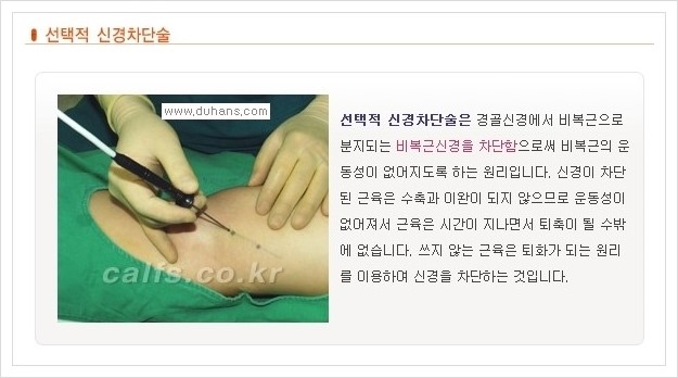 [두한성형외과 경쟁력 멀티종아리성형] - [날씬한 종아리를 만드는 다양한 시술방법의 장점, 단점 안내] 관련 이미지 2
