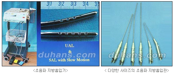 [Duhan Plastic Surgery Simple Liposuction] - [Liposuction for Obesity] image 4
