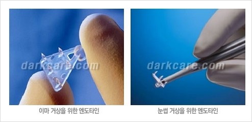 ​[두한성형외과 동안성형] - ​[하안검수술, 상안검수술, 눈썹거상술] 관련 이미지 93