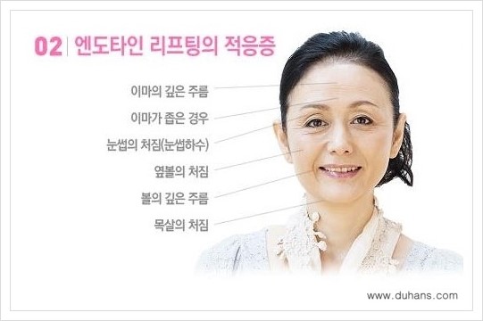 [두한성형외과 경쟁력 동안성형 리더] - ​[미간주름, 이마주름, 안검성형, 이마거상술, 눈썹거상술] 관련 이미지 38