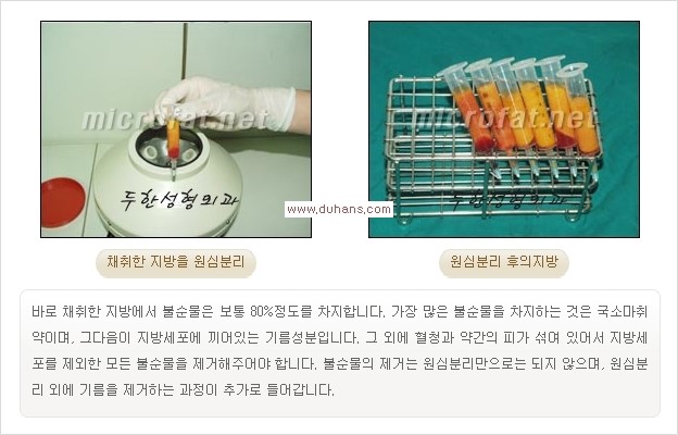 [두한성형외과 경쟁력 주름성형] - [필러주사(쥬비덤)에 대한 올바른 정보 안내] 관련 이미지 5