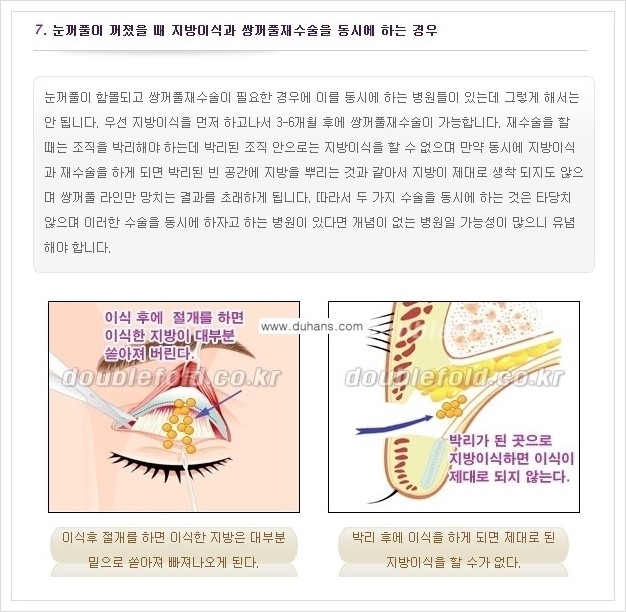 [두한성형외과 경쟁력 쌍꺼풀 재수술, 극한 재수술] - [쌍꺼풀 재수술 실패 원인(Cause of reoperation fail) 안내] 관련 이미지 7