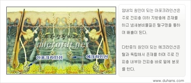 [두한성형외과 경쟁력 액취증, 다한증 치료] - [겨드랑이의 참기 힘든 냄새와 땀 치료 - 초음파 컷터지방흡입 + 리포셋 소파흡입술] 관련 이미지 6