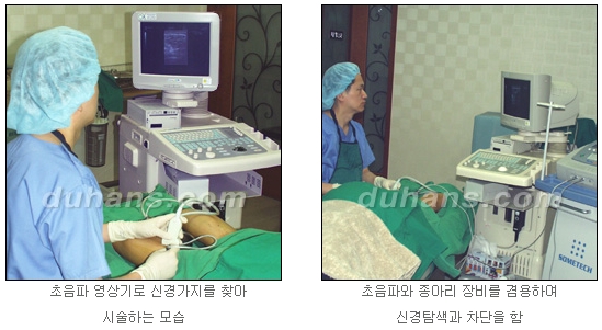 [두한성형외과 종아리 퇴축] - [종아리 퇴축술 재발 재수술] 관련 이미지 9