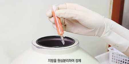 [두한성형외과 다크서클] - [콜펫지방이식] 관련 이미지 8