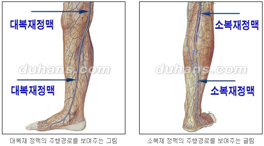 [두한성형외과 정맥류] - [하지정맥류, 정맥확장증, 혈관확장증] 관련 이미지 5