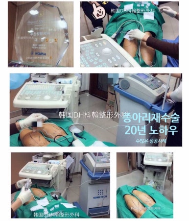 [종아리알제거 두한성형외과] - [초음파유도선택적신경차단술] 관련 이미지 28