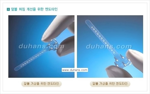 [두한성형외과 경쟁력 주름교정술] - [엔도타인 리프팅 안내 ③] 관련 이미지 6