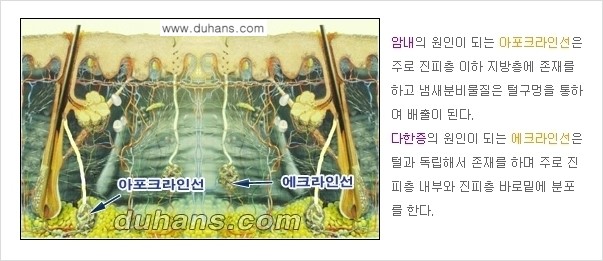 [두한성형외과 성형 FOCUS 지방흡입] - [액취증 - 다한증 초음파 컷터 지방흡입 ②] 관련 이미지 9