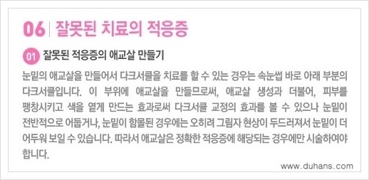 [두한성형외과 경쟁력 눈밑성형] - [다크써클 치료 실패의 원인 안내 ②] 관련 이미지 5