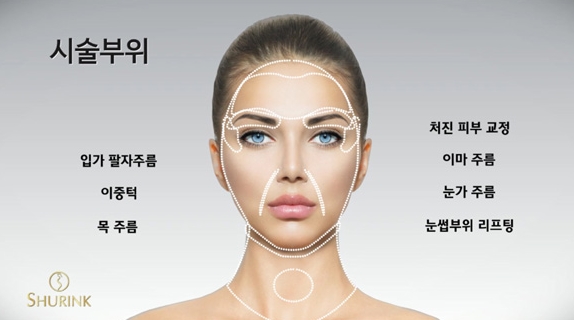 두한성형외과 주름개선 - 주름 HIFU 리프팅 관련 이미지 6