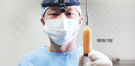 [두한성형외과 다크서클] - [콜펫지방이식] 관련 이미지 7