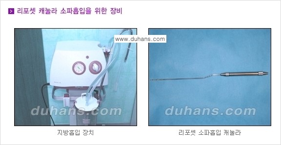 [두한성형외과 성형 FOCUS 지방흡입] - [액취증 - 다한증 초음파 컷터 지방흡입 ⑤] 관련 이미지 4