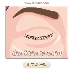 [두한성형외과 경쟁력 안검성형] - [젊어 보이면서 개선된 인상을 주기 위한 성형] 관련 이미지 8