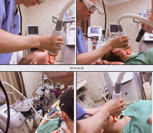 [Duhan Plastic Surgery Wrinkle Improvement] - [Wrinkle Lifting] image 9