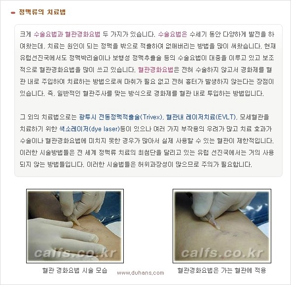 [두한성형외과 경쟁력 멀티종아리성형] - [종아리성형 방법별 전후 주의사항] 관련 이미지 32