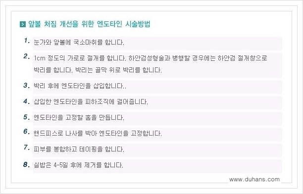 [두한성형외과 경쟁력 주름성형] - [눈썹거상, 앞볼처짐 개선의 엔도타인 리프팅] 관련 이미지 7