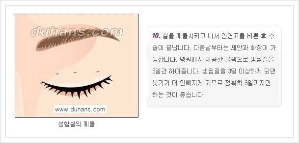 [두한성형외과 경쟁력 눈성형] - [퀵쌍꺼풀 안내] 관련 이미지 11