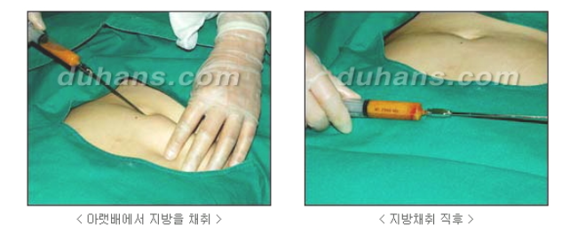 눈밑 다크써클 개선 원리 관련 이미지 6
