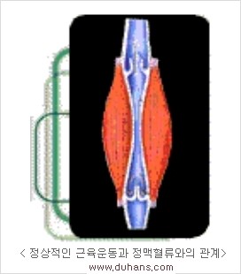 [두한성형외과 경쟁력 정맥류 치료] - [정맥류의 원인 안내] 관련 이미지 3