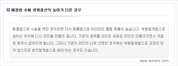 [두한성형외과 경쟁력 눈성형] - [짝짝이(비대칭) 쌍꺼풀 라인 교정하는 방법 안내 1.] 관련 이미지 1