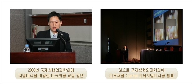 [두한성형외과 경쟁력 눈밑성형] - [눈밑 다크써클 원인과 눈밑 다크써클 증상] 관련 이미지 2