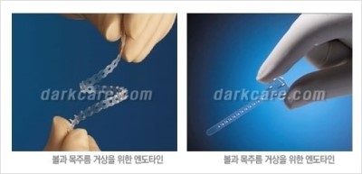 [두한성형외과 경쟁력 주름성형] - [세월의 흔적! 주름을 교정하는 여러 가지 교정 방법] 관련 이미지 34