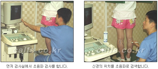 [두한성형외과 종아리퇴축술] - [NO절개! 초음파유도신경차단술] 관련 이미지 8