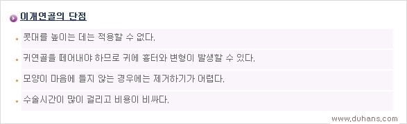 [두한성형외과 경쟁력 코성형] - [여러 가지 코성형 방법 안내] 관련 이미지 9