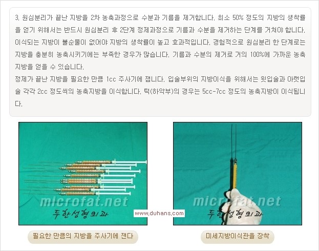 [두한성형외과 경쟁력 미세지방이식] - [부드럽고 아름다운 얼굴윤곽선 턱(하악부) 미세지방이식 안내] 관련 이미지 10