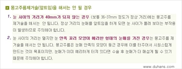 [두한성형외과 NO.1 눈성형] - [몽고주름 제거(앞트임 수술) 2.] 관련 이미지 13