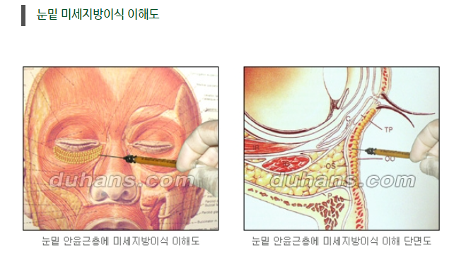 눈밑 다크써클 개선 원리 관련 이미지 8