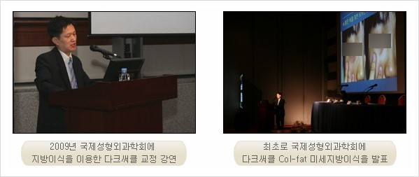[두한성형외과 경쟁력 눈밑성형 리더] - [윗눈꺼풀 지방제거, 눈밑지방제거, 눈밑지방재배치, 눈밑지방이식 안내] 관련 이미지 5