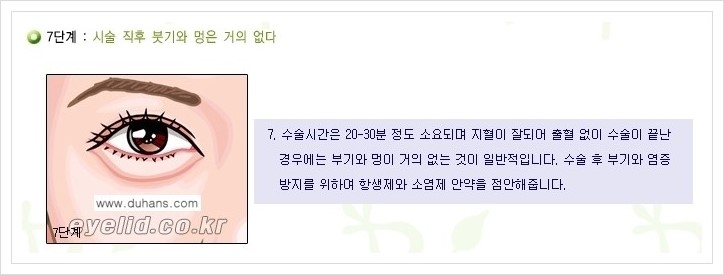 [두한성형외과 경쟁력 지방제거] - [윗눈꺼풀 지방제거, 아랫 눈꺼풀 지방제거  안내 2.] 관련 이미지 7