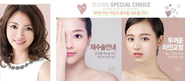 [DoubleFold Plastic Surgery Eye Surgery] - [Revision Surgery for Thick Double Eyelids] image 53