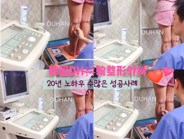 [DuHan Plastic Surgery Calf Contouring] - [Methods and Problems of Calf Muscle Reduction] image 19
