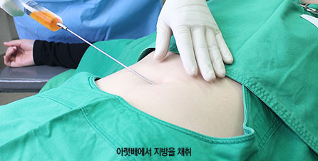 [눈밑수술 두한성형외과] - [다크서클 콤비프로그램] 관련 이미지 46