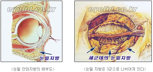 [두한성형외과 지방제거] - [눈두덩이지방제거, 눈밑지방제거] 관련 이미지 11