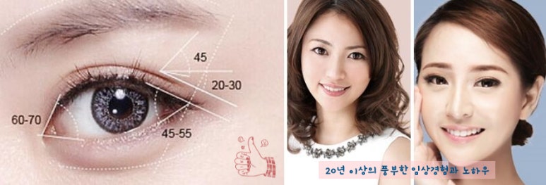 [Duhan Plastic Surgery Double Eyelid Surgery] - [Types of Double Eyelid Surgery] image 49
