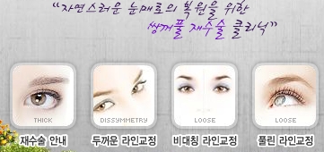 쌍꺼풀 재수술 Dr. 컬럼 관련 이미지 6