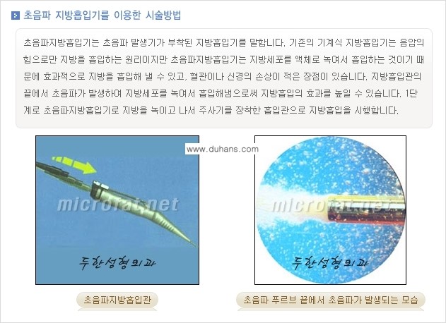 [두한성형외과 겨울엔 지방흡입 도전] - [간편한 복부지방흡입 1.] 관련 이미지 4